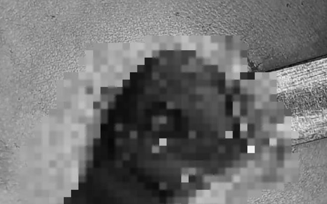 Nghịch súng tự chế của bố, anh trai chẳng may bắn trúng ngực em 4 tuổi Ảnh 2