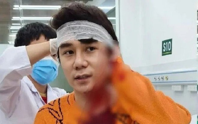 Nam diễn viên 'Thương ngày nắng về' bị chém gây thương tích vì mâu thuẫn khi trên đường về nhà Ảnh 2