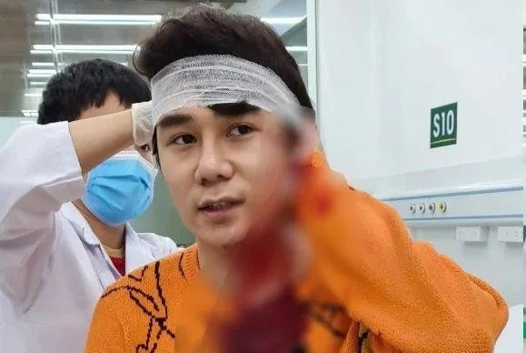 Nam diễn viên Ngô Sỹ Lâm bị chém nhiều nhát do mâu thuẫn khi tham gia giao thông. 