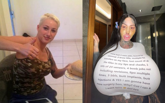 Chi hơn 2 tỷ phẫu thuật thẩm mỹ, 9X xinh như mộng nhận cái kết đắng Ảnh 2