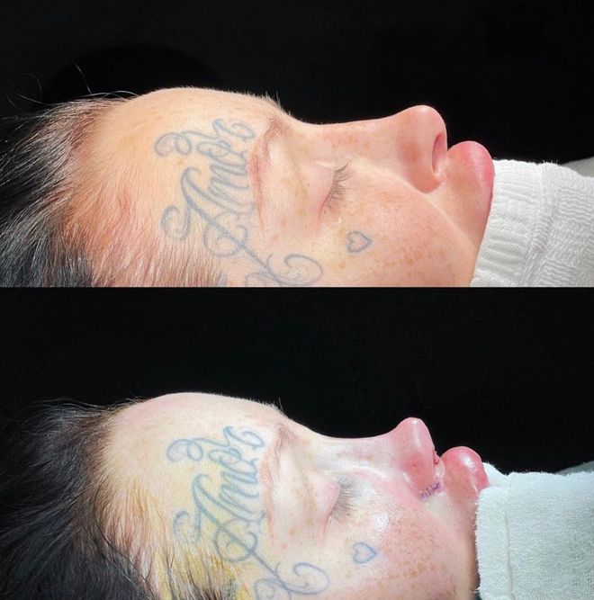 Chi hơn 2 tỷ phẫu thuật thẩm mỹ, 9X xinh như mộng nhận cái kết đắng Ảnh 6