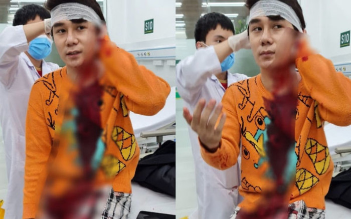 Nguyên nhân vụ nam diễn viên phim 'Thương ngày nắng về' bị chém giữa phố Hà Nội Ảnh 2