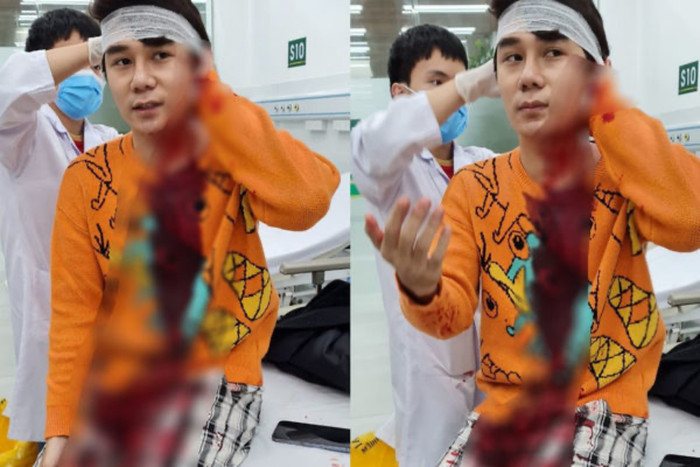 Các bác sĩ cấp cứu cho nam diễn viên tại bệnh viện.