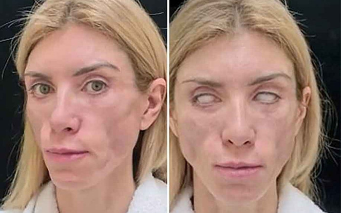 Mắt cựu Á hậu Nga bỗng trợn trừng không nhắm được, căn nguyên là do 1 việc chị em đua nhau làm Ảnh 2