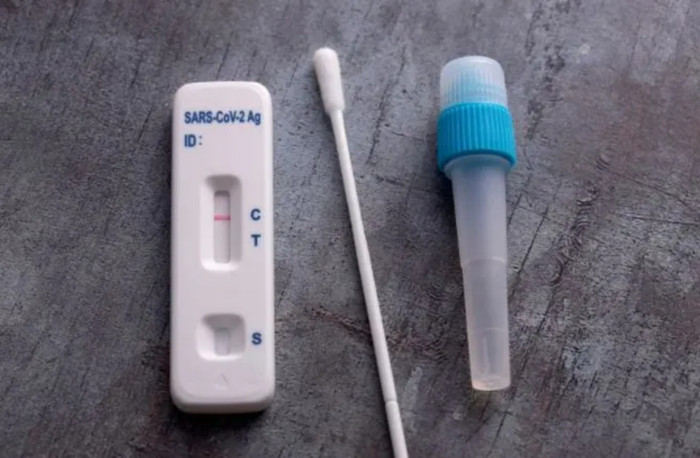 Bác sĩ chỉ cách phát hiện dương tính giả khi tự làm test nhanh Covid-19 tại nhà Ảnh 4