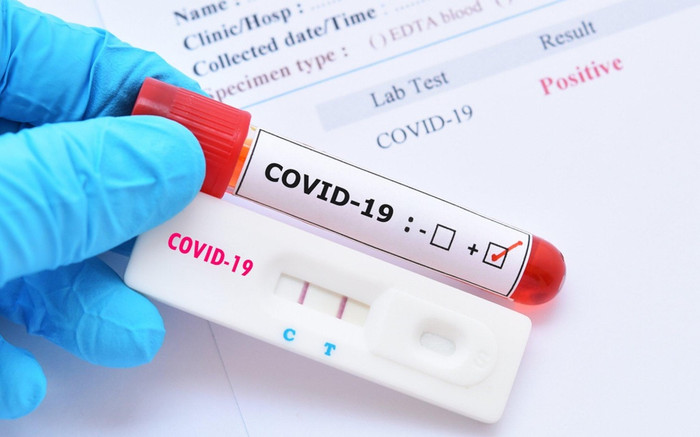 Bác sĩ chỉ cách phát hiện dương tính giả khi tự làm test nhanh Covid-19 tại nhà Ảnh 2