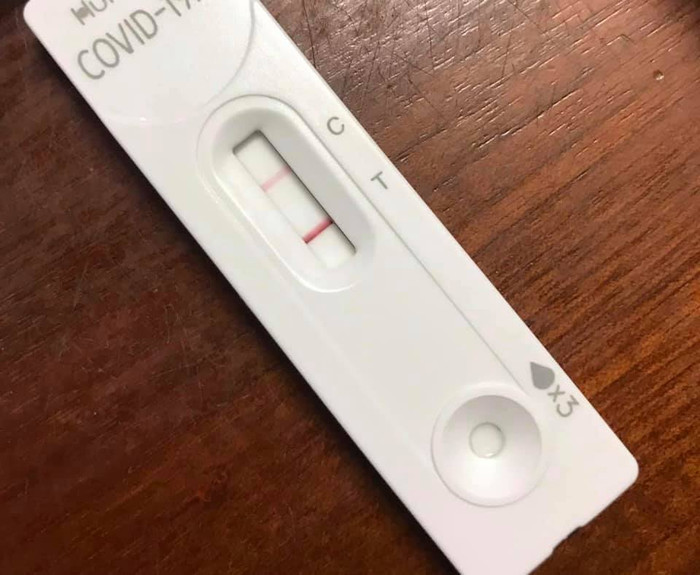 Vạch mờ hay đậm không khẳng định bênh nặng hay nhẹ