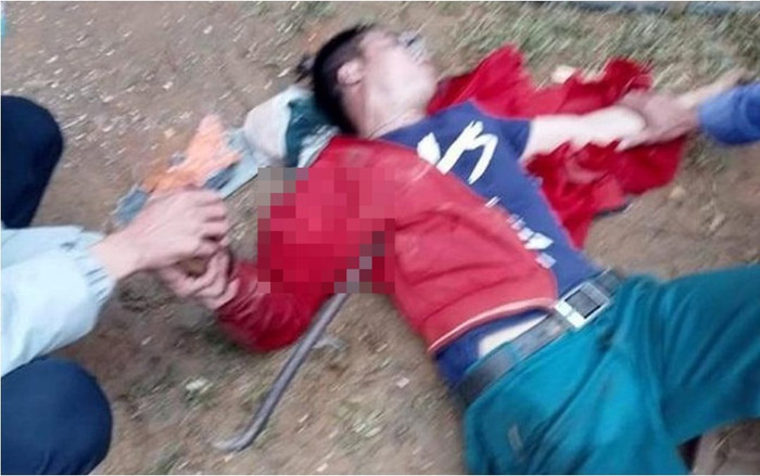 Người đàn ông bị xà beng đâm xuyên ngực khi rơi từ mái nhà xuống Ảnh 2
