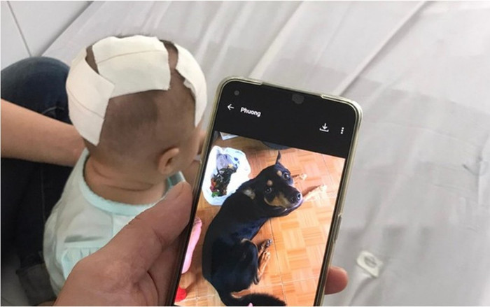 Xót xa bé gái 6 tháng tuổi bị chó cưng cắn xuyên xương sọ Ảnh 2