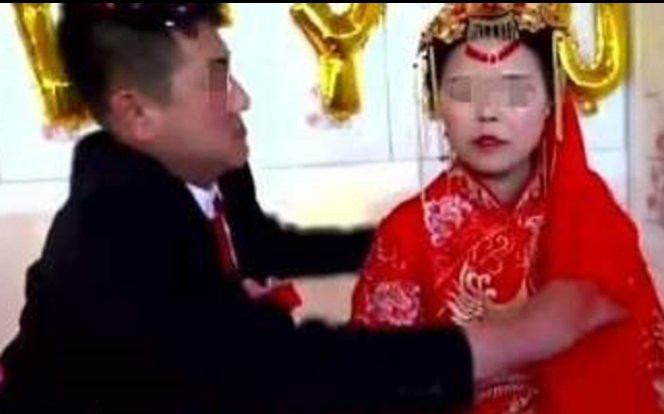 Da bụng vợ rạn chằng chịt nhưng chưa từng sinh con, chồng hoài nghi hỏi bác sĩ mới 'té ngửa' vì sự thật Ảnh 2