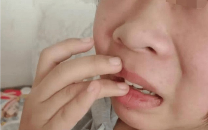 Nữ sinh lớp 8 bị thầy Hiệu phó tát liên tiếp 30 cái, dùng chân đạp vào người Ảnh 2