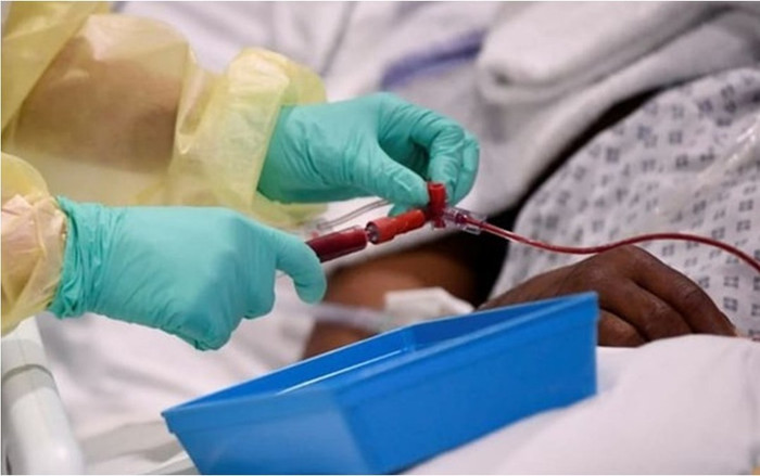 Phát hiện mới về gene ở những người nhiễm Covid-19 nặng Ảnh 2