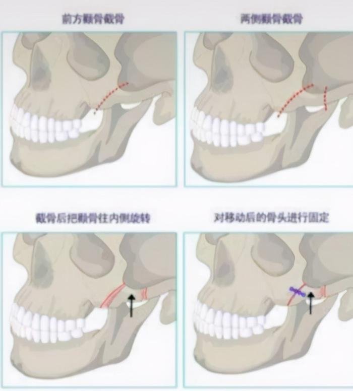 Cúc Tịnh Y gây tranh cãi vì cảnh 'bắt cóc ngậm khăn': Giữ hình tượng hay không thể diễn? Ảnh 4