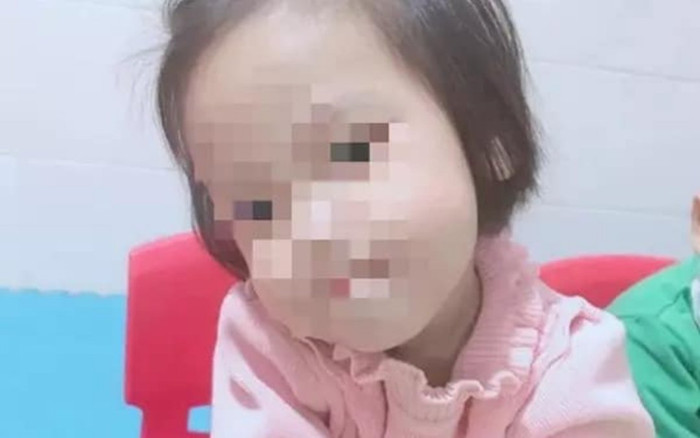 Xác định có 10 chiếc đinh trong hộp sọ bé gái bị bạo hành Ảnh 2