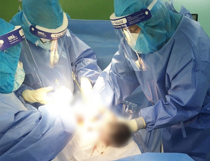 Các bác sĩ tiến hành phẫu thuật lấy thai, cấp cứu. (Ảnh: BVCC).