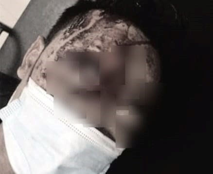 Anh rể sát hại em vợ lúc đang ngủ nhưng bất thành Ảnh 3