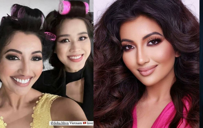 Á hậu Miss World 2021 từng bị bỏng mặt nặng, xem lại ảnh mà thương xót Ảnh 2