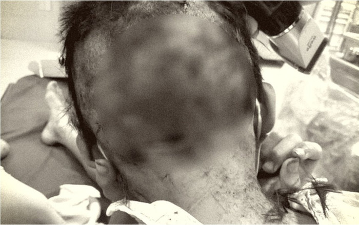 Bé trai bị chó 20 kg tấn công, chằng chịt vết thương trên đầu và tay chân Ảnh 2