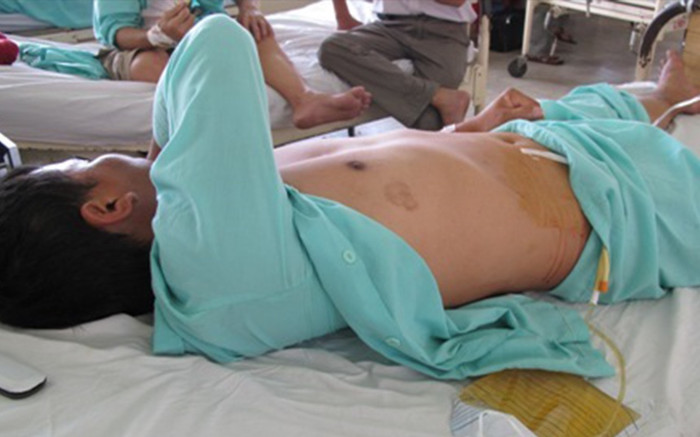 Sơn La: Người đàn ông bị vợ cắt 'của quý' vì mâu thuẫn gia đình Ảnh 2