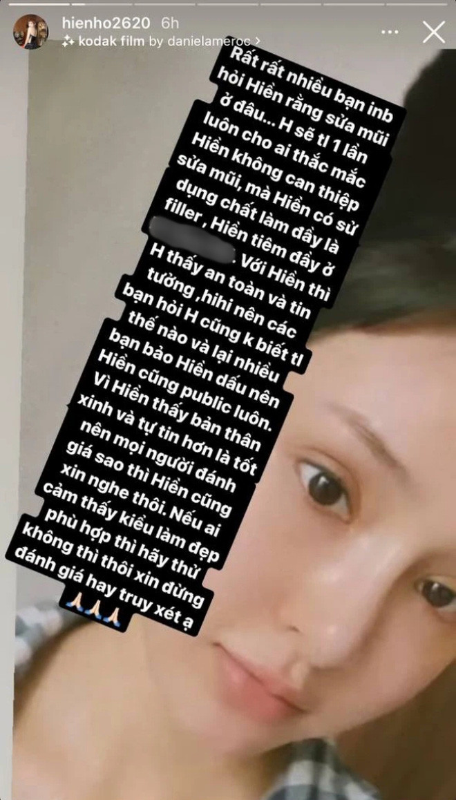 Hiền Hồ chia sẻ, cô không đụng đến dao kéo mà chỉ tiêm filler, để phần mũi thêm cao, thẳng.