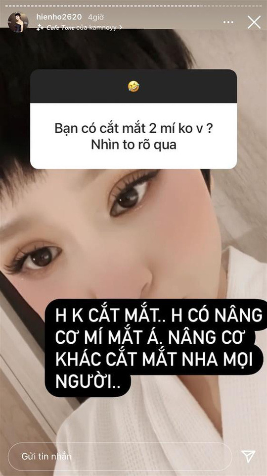 Tiếp theo Hiền Hồ chia sẻ mình không cắt mắt mà chỉ nâng cơ mí mắt.