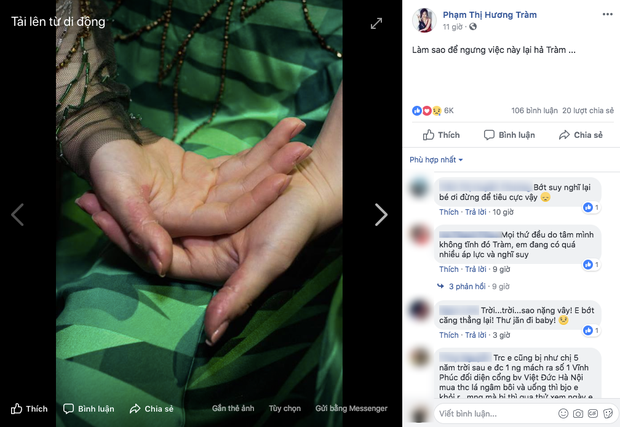 Sao Việt vật lộn với chứng rối loạn lưỡng cực: Hương Tràm sử dụng thuốc an thần, Karik dần thu mình lại Ảnh 6