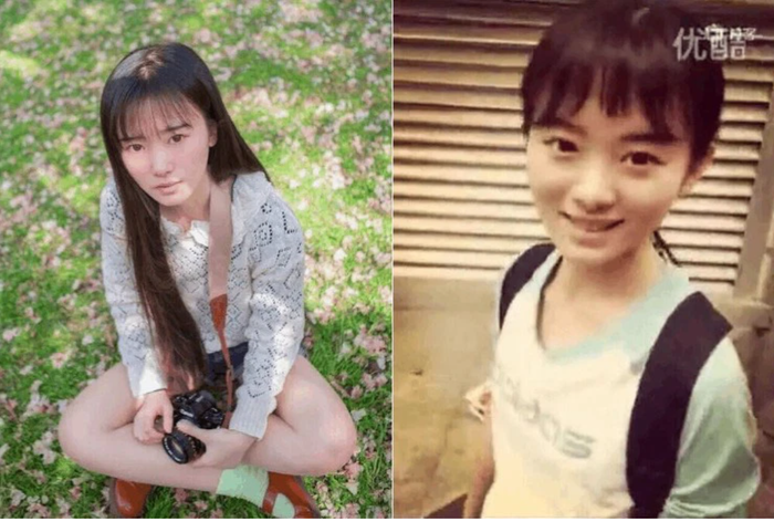 So với trước khi, gương mặt của Cúc Tịnh Y đã thon gọn và mềm mại hơn hẳn.