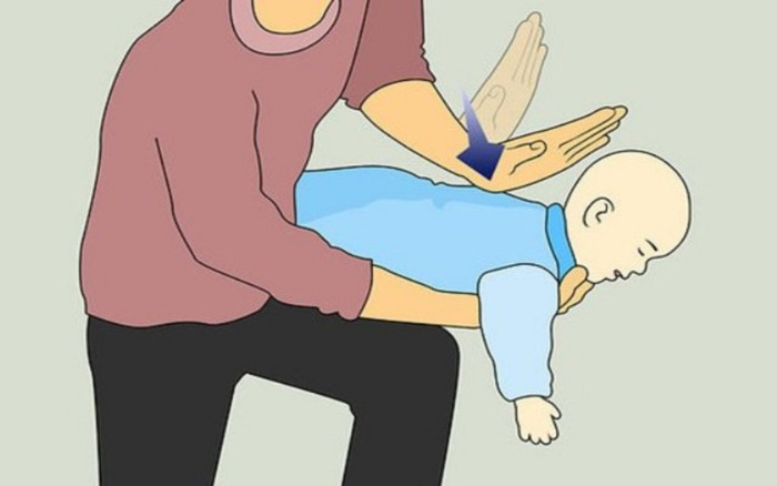 Bé gái 5 tuổi bị ngưng tuần hoàn máu sau khi ăn lạc Ảnh 2