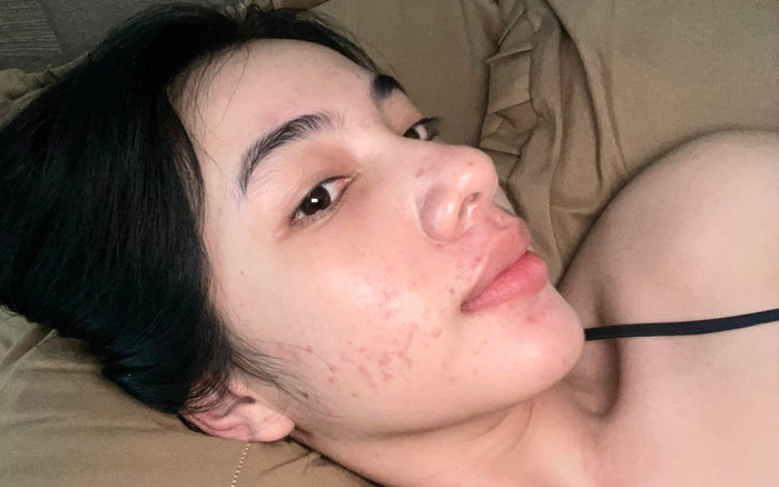 Cẩm Đan - 'tình tin đồn' chồng cũ Lệ Quyên lộ mặt đầy mụn gây sốc Ảnh 2