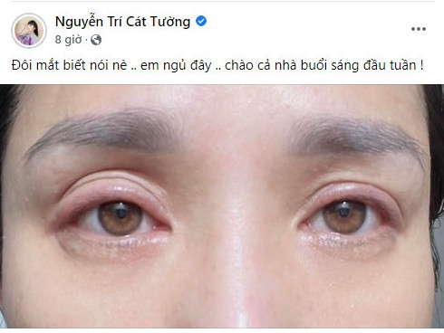 Cát Tường gây sốc khi xuất hiện với mí mắt sưng húp Ảnh 3
