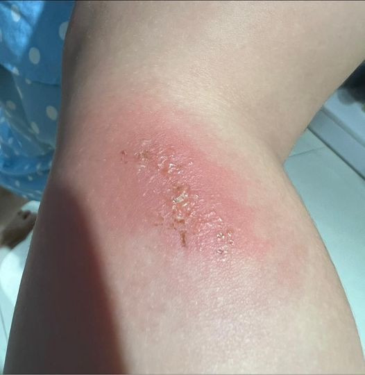 Hình ảnh mới nhất về tình trạng sức khỏe của con gái nữ ca sĩ được cô đăng lên trang cá nhân