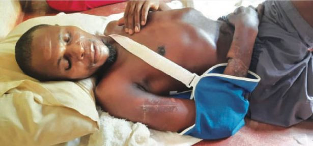 Người đàn ông sống sót sau khi bị ít nhất 3 con cá sấu 'xâu xé', phải thọc cả tay vào miệng con vật Ảnh 4