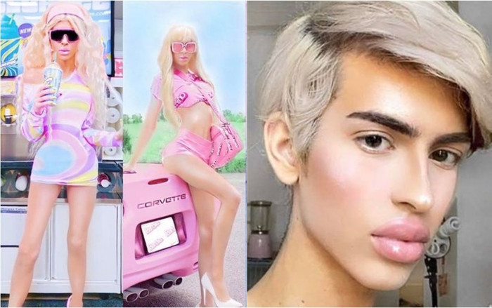 Mạnh tay chi 3,5 tỷ phẫu thuật thành búp bê, chàng trai thành triệu phú năm 21 tuổi Ảnh 2