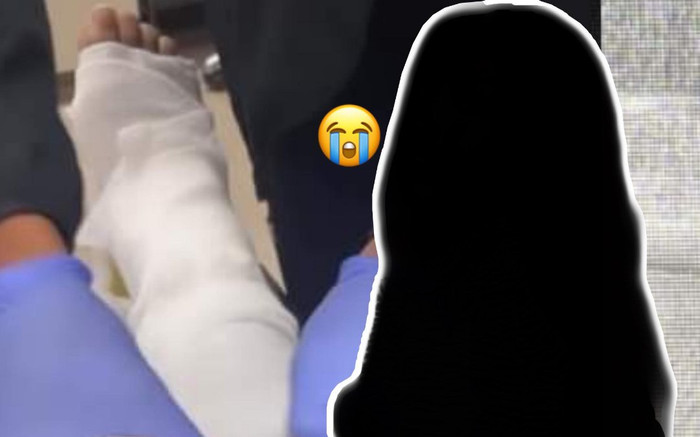 Nữ ca sĩ thông báo bị gãy chân sau khi tham gia một sự kiện Ảnh 2