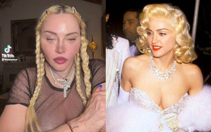 'Nữ hoàng nhạc Pop' Madonna xuất hiện với diện mạo khó tin: Khuôn mặt đơ cứng thiếu tự nhiên Ảnh 2