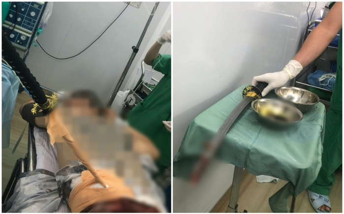 Cứu sống nam thanh niên nhập viện với thanh kiếm đâm xuyên thắt lưng Ảnh 2
