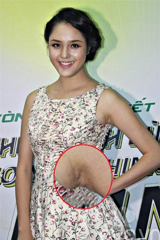 Không riêng gì Minh Hằng, Á hậu Hoàng Anh cũng từng là nạn nhân của việc để lộ khuyết điểm vùng nách. Trong một bức ảnh trên thảm đỏ sự kiện, người đẹp đã để lộ rõ vùng nách thâm đen, sần sùi khi diện váy ngắn tay.