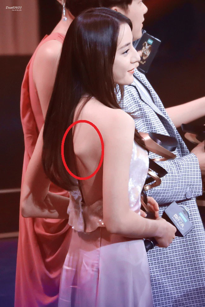 Sao Hoa ngữ giảm cân quá đà: La Vân Hi chỉ còn 'da bọc xương', Cúc Tịnh Y lộ khuôn mặt biến dạng Ảnh 17