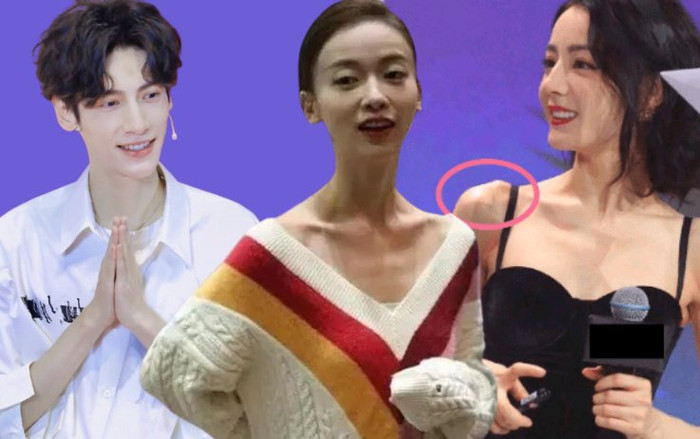 Sao Hoa ngữ giảm cân quá đà: La Vân Hi chỉ còn 'da bọc xương', Cúc Tịnh Y lộ khuôn mặt biến dạng Ảnh 2