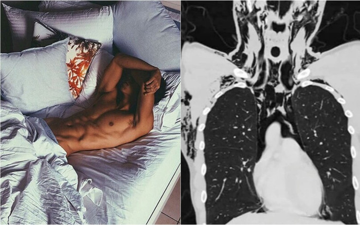 Thanh niên bị chấn thương hiếm gặp do 'tự sướng' Ảnh 2