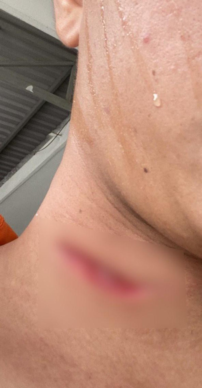 Ông Liên bị Thuận tấn công gây thương tích