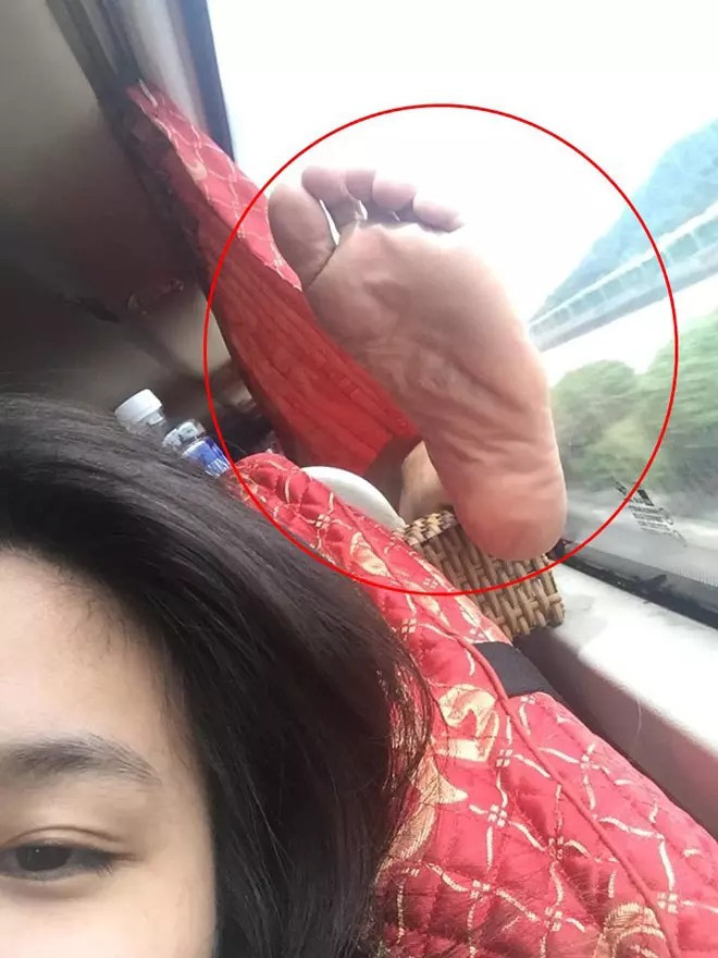 Dẫu biết rằng người gác chân sẽ thoải mái nhưng người bị gác chân sẽ 'đau khổ' như thế nào đây