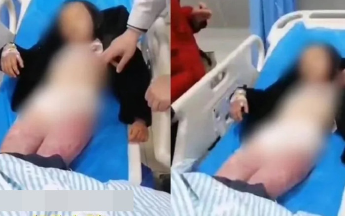 Mẹ dùng móc treo quần áo đánh con gái đến nhập viện, lý do khiến ai cũng 'sôi máu' Ảnh 1