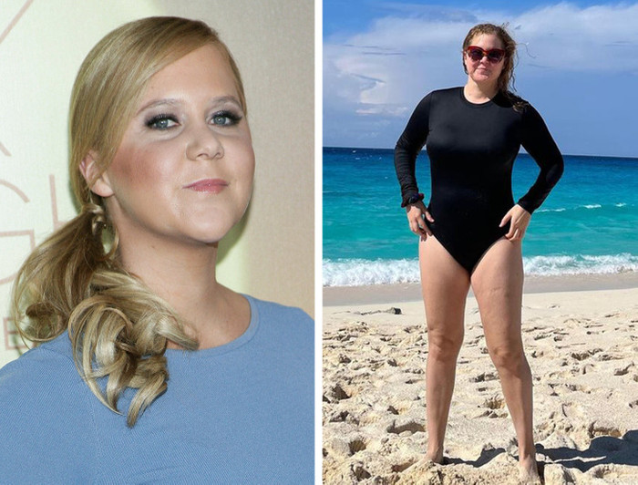 Amy Schumer từng làm thủ tục hút mỡ. Cô giải thích rằng cô phải đụng vào dao kéo vì nhiều nguyên nhân như mang thai khó khăn, mắc các bệnh hậu sinh nở, bệnh lạc nội mạc tử cung, phẫu thuật cắt bỏ tử cung, mổ ruột thừa.