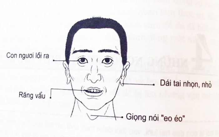 4 nét tướng đàn ông lắm điều nhiều chuyện, dễ gây thị phi khiến ai cũng không ưa Ảnh 2
