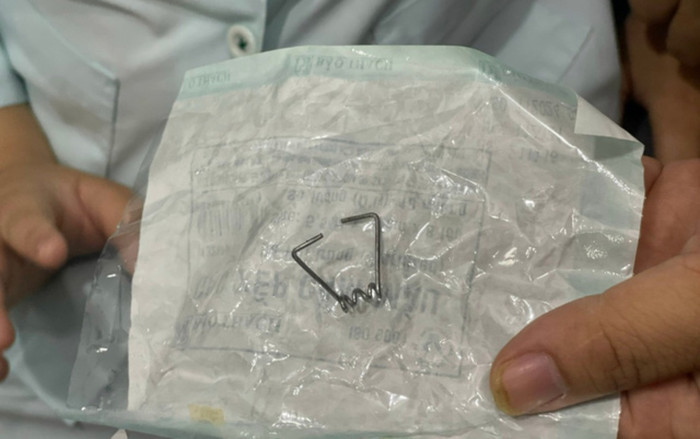 Cấp cứu bé trai 9 tuổi mắc bệnh tự kỷ nuốt lò xo vào cổ họng Ảnh 2