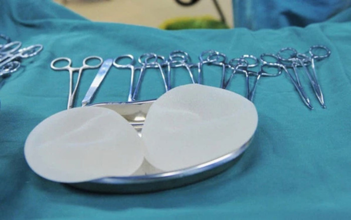 Người phụ nữ 61 tuổi tử vong sau khi nâng ngực tại Bệnh viện Thẩm mỹ Kangnam Ảnh 2