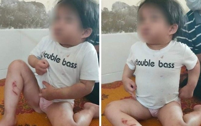 Hà Tĩnh: Công an vào cuộc điều tra vụ bé gái 4 tuổi nghi bị bạo hành Ảnh 2