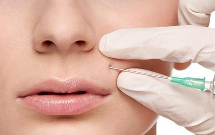 Tiêm filler làm đầy rãnh má tại tiệm tóc, người phụ nữ bị mất thị lực Ảnh 2