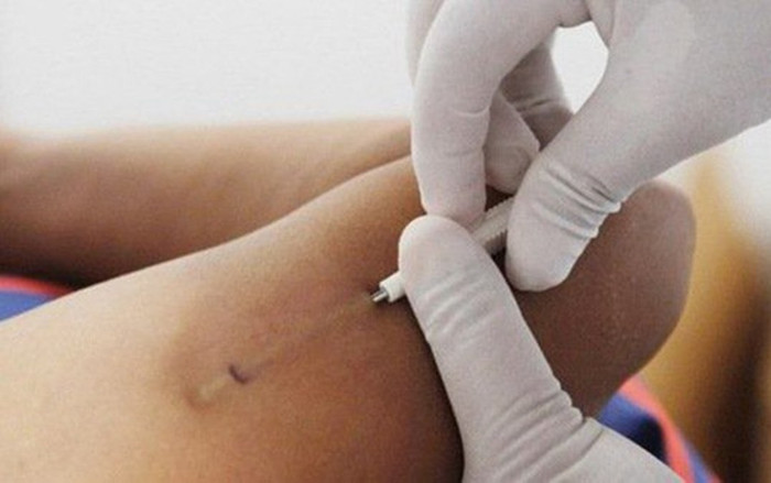 Đi cấy que nhưng vẫn mang thai, nhiều phụ nữ 'ngã ngửa' trước sự thật về nam bác sĩ Ảnh 2